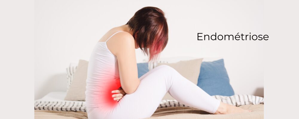 Endométriose article 1